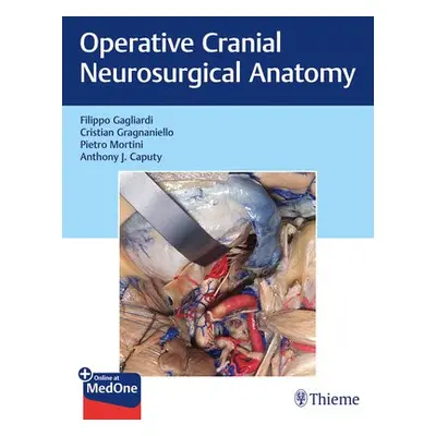 Operative Cranial Neurosurgical Anatomy - Gagliardi, Filippo a Gragnaniello, Cristian a Mortini,