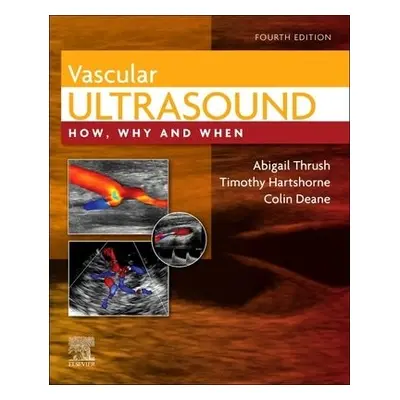 Vascular Ultrasound