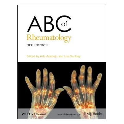 ABC of Rheumatology