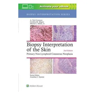 Biopsy Interpretation of the Skin - Crowson, A. Neil a Magro, Cynthia M.