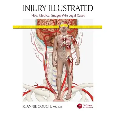 Injury Illustrated - Gough, R. Annie