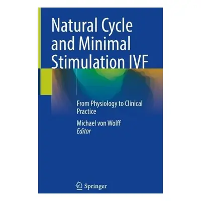 Natural Cycle and Minimal Stimulation IVF