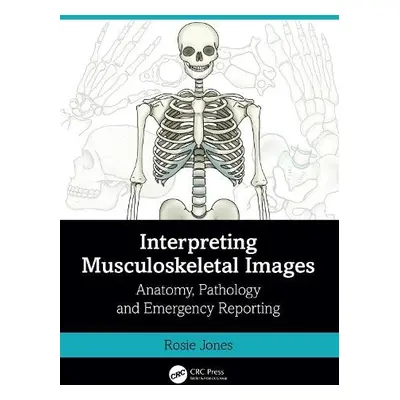 Interpreting Musculoskeletal Images - Jones, Rosie (Uni Hospitals of North Midlands)