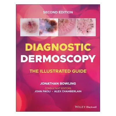 Diagnostic Dermoscopy