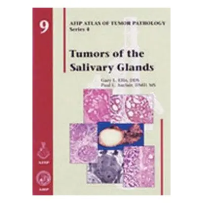 Tumors of the Salivary Glands - Ellis, Gary L. a Auclair, Paul L.