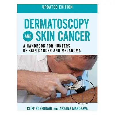 Dermatoscopy and Skin Cancer, updated edition - Rosendahl, Cliff a Marozava, Aksana