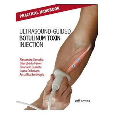 Practical Handbook for Ultrasound-guided Botulinum Toxin Injection