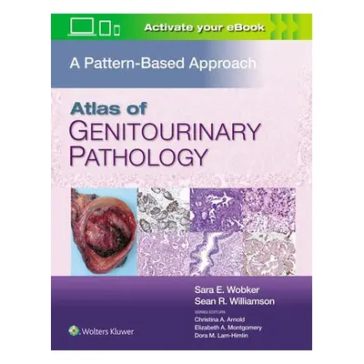 Atlas of Genitourinary Pathology - Wobker, Sara E., MD, MPH a Williamson, Sean R., MD, FASCP