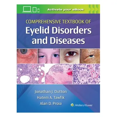 Comprehensive Textbook of Eyelid Disorders and Diseases - Dutton, Jonathan, MD, PhD a Proia, Ala