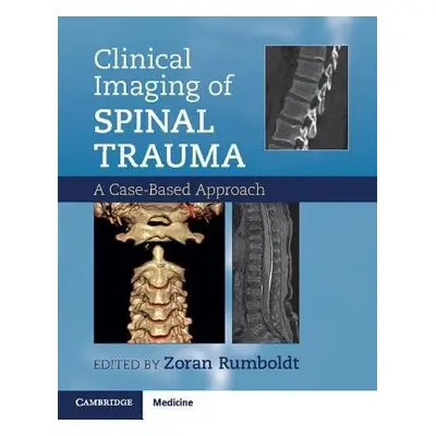 Clinical Imaging of Spinal Trauma