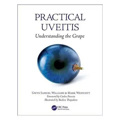 Practical Uveitis - Williams, Gwyn Samuel a Westcott, Mark