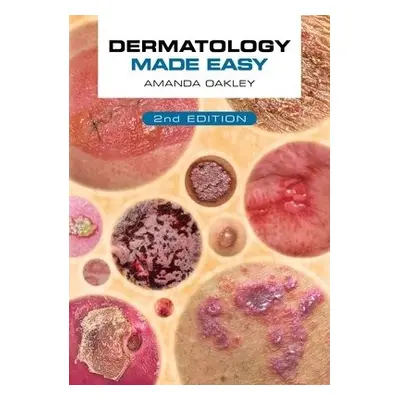 Dermatology Made Easy, second edition - Oakley, Amanda (Honorary Professor, Department of Medici