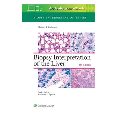 Biopsy Interpretation of the Liver - Torbenson, Michael, MD