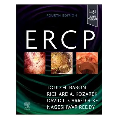 ERCP