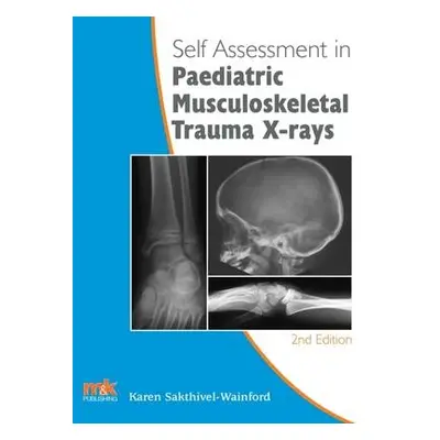 Self-Assessment in Paediatric Musculoskeletal Trauma X-Rays - Sakthivel-Wainford, Karen